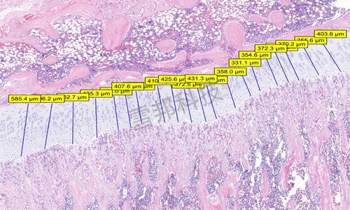 Masson（蓝、绿）