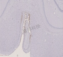 Masson（蓝、绿）