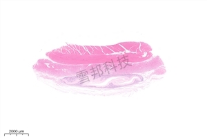 高分子材料肌肉植入
